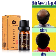10ml Professional Hair Growth Essence Oil Pure Natural Hair Loss Liquid Dense Hair Fast Sunburst Hair Grow Restoration Pilatory