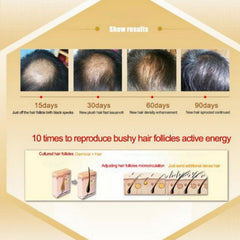 Hair Growth Essential Oils Ginseng Ginger Hair Care Improve Hair Loss Thick Hair Growth Essence Liquid