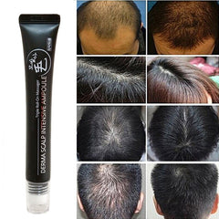 20ml Hair Growth Serum Derma Scalp Triple Roll Massager Fast Regrow Hairline Hair Loss Essence S1