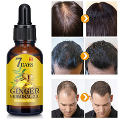 New Arrive 7 Day Ginger Germinal Serum Essence Oil 30ML Natural Hair Loss Treatement Effective Fast Growth Hair Care S1