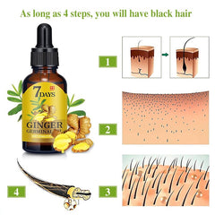 New Arrive 7 Day Ginger Germinal Serum Essence Oil 30ML Natural Hair Loss Treatement Effective Fast Growth Hair Care S1