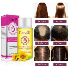 Herbal Hair Growth Essential Oil Hair Repair Promote Hair Growth For Women And Men Hair Growth Treatment NEW