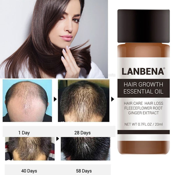 LANBENA 20ML Powerful Hair Growth Essential Oil Treatment Anti Hair Loss Hair Care Repair Hurt Hair Hair Care Products TSLM2