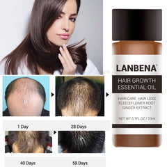 LANBENA 20ML Powerful Hair Growth Essential Oil Treatment Anti Hair Loss Hair Care Repair Hurt Hair Hair Care Products TSLM2