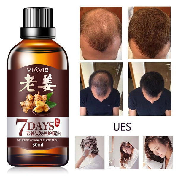 30ml Hair Loss Treatment Ginger Hair Care Fast Hair Growth Essence Oil for Men Women TSLM2