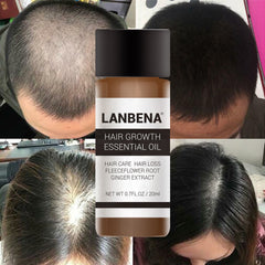 LANBENA 20ML Powerful Hair Growth Essential Oil Treatment Anti Hair Loss Hair Care Repair Hurt Hair Hair Care Products TSLM2