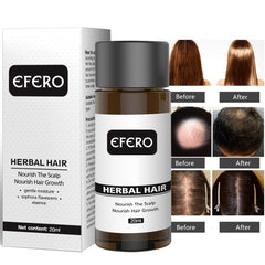 Efero Hair Care Hair Growth Essential Oils Hair Anti-Loss Serum Powerful Hair Growth Health Care Beauty Hair Care TSLM2