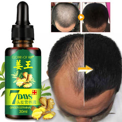 30ML Effective Hair Growth Ointment Hair Anti-off Care Healthy Hair Growth Essence Oil TSLM2