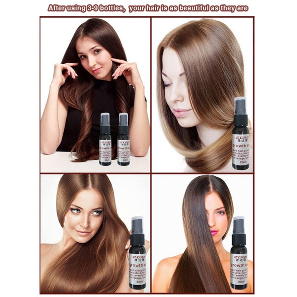 100% Authentic Prevent Hair Loss Hair Thicken Growth Liquid Spray For Women Men Dry Hair Repair Moisturizer Treatment Serum Hot