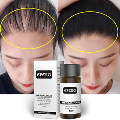 Efero Hair Care Hair Growth Essential Oils Hair Anti-Loss Serum Powerful Hair Growth Health Care Beauty Hair Care TSLM2