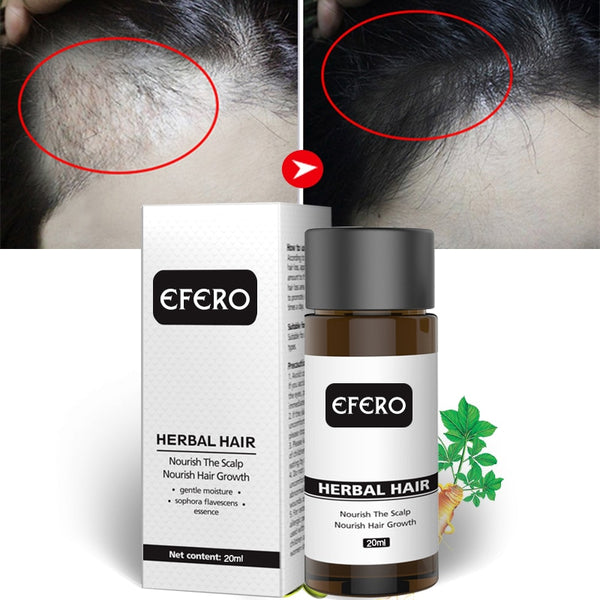 Efero Hair Care Hair Growth Essential Oils Hair Anti-Loss Serum Powerful Hair Growth Health Care Beauty Hair Care TSLM2