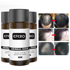 20ml Anti-Hair Loss Powerful Growth Essence Nourish Hair Oil Anti Hair Loss Prevent Baldness Maintenance Hair Care