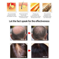 Fast Powerful Hair Growth Essence Hair Loss Products Essential Oil Treatment