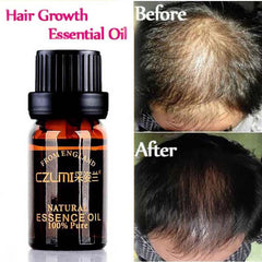 Hair Care Natural With No Side Effects Loss Products Grow Hair Faster Regrowth Hair Growth Products New Arrival