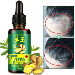 30ML Effective Hair Growth Ointment Hair Anti-off Care Healthy Hair Growth Essence Oil TSLM2