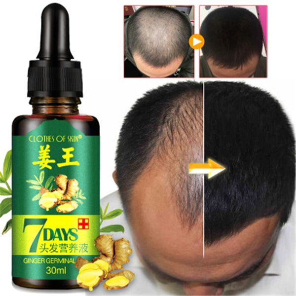 7 Days Ginger Hair Growth Essence Germinal Oil Hair Care Scalp Treatment for Anti-hair loss 30ml