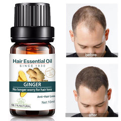 10ml Ginger Hair Care For Dry Damaged Hair