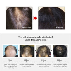 10ml Ginger Hair Care For Dry Damaged Hair