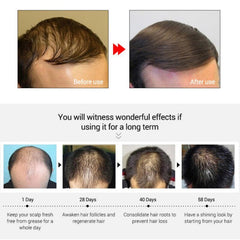 Fast Powerful Hair Growth Essence Hair Loss Products Essential Oil Treatment