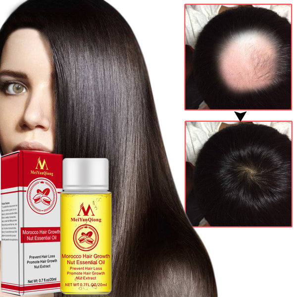 20ml Nut Hair Care Growth Liquid Hair Nourishing keratin Care Serum Essence Hair Growth Prevention Hair Loss Essential Oil