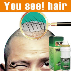 60ml Powerful pilatory hair growth Hair treatment original Regain Hair Loss Treatment Extra Stong Fast Growth Liquid 2019