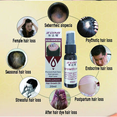 100% Authentic Prevent Hair Loss Hair Thicken Growth Liquid Spray For Women Men Dry Hair Repair Moisturizer Treatment Serum Hot