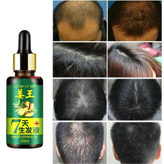 30ML Effective Hair Growth Ointment Hair Anti-off Care Healthy Hair Growth Essence Oil TSLM2