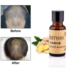 Natural Extract  Hair Loss Liquid Hair Products 100% Hair Loss Liquid Health Care  Hair Growth Essential Oils Authentic Repair