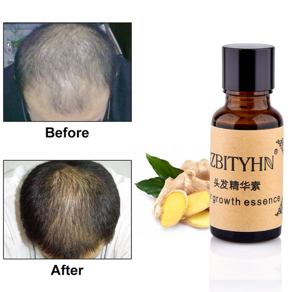 Natural Extract  Hair Loss Liquid Hair Products 100% Hair Loss Liquid Health Care  Hair Growth Essential Oils Authentic Repair
