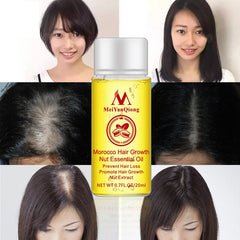 20ml Nut Hair Care Growth Liquid Hair Nourishing keratin Care Serum Essence Hair Growth Prevention Hair Loss Essential Oil