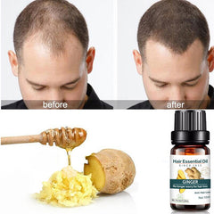 10ml Ginger Hair Care For Dry Damaged Hair
