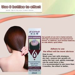 100% Authentic Prevent Hair Loss Hair Thicken Growth Liquid Spray For Women Men Dry Hair Repair Moisturizer Treatment Serum Hot