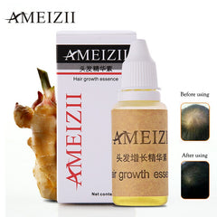 Hair Growth Essence Hair Growth Fluid 20ml Hair Fast Sunburst Hair Growth Product Restoration Pilatory
