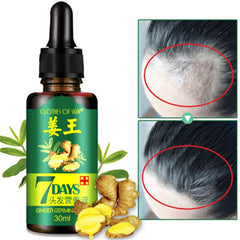 7 Days Ginger Hair Growth Essence Germinal Oil Hair Care Scalp Treatment for Anti-hair loss 30ml