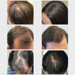 20ml Fast Powerful Hair Products Hair Care Prevent Baldness Anti-Hair Loss Serum Nourishing Hair Growth Essential Oil