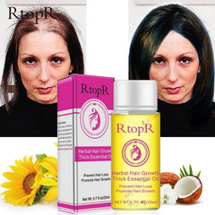 Herbal Hair Growth Essential Oil Hair Repair Promote Hair Growth For Women And Men Hair Growth Treatment NEW