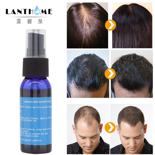 Y&F&W Natural 30ml Chinese Herb Fast Growing Progress Growth Speed Hair Care Hair Treament For Men and Women