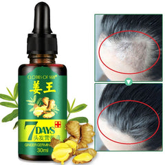 Hair Loss Treatment 7 Days Ginger Hair Growth Serum For Thicker Healthier Hair Hair Care For Men And Women
