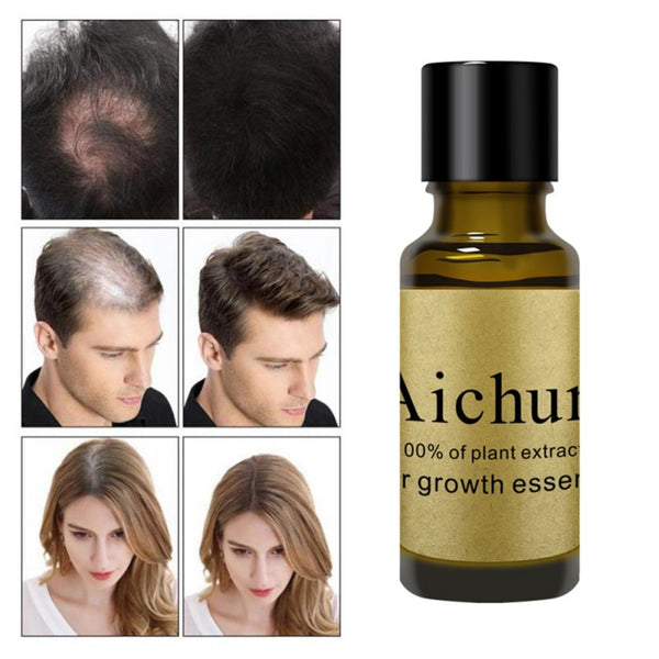 Hair Hair Growth Essential Oil Anti-fork Anti-hair Loss Hair Nourishing Hair Scalp Repair Dyeing Perming Growth Essential Oil S1