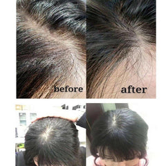20ml Hair Growth Serum Derma Scalp Triple Roll Massager Fast Regrow Hairline Hair Loss Essence S1