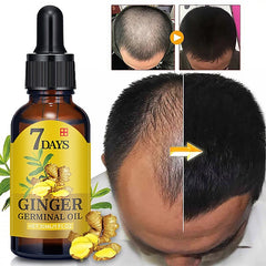 New Arrive 7 Day Ginger Germinal Serum Essence Oil 30ML Natural Hair Loss Treatement Effective Fast Growth Hair Care S1